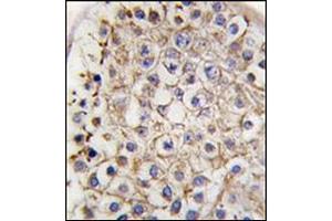 Formalin-Fixed, Paraffin-embedded human testis tissue reacted with Autophagy LC3B Antibody (C-term) followed which was peroxidase-conjugated to the secondary antibody, followed by DAB staining.