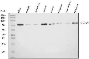 Western blot analysis of RANGAP1 using anti-RANGAP1 antibody (ABIN7600225). (RANGAP1 抗体  (AA 165-587))