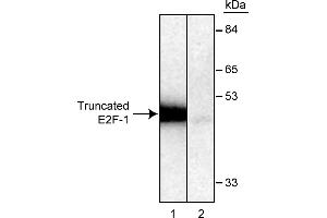 Western Blotting (WB) image for anti-E2F Transcription Factor 1 (E2F1) antibody (ABIN967439) (E2F1 抗体)