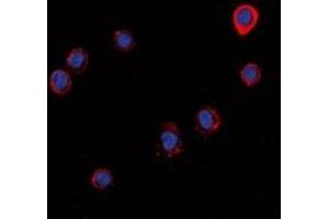Immunofluorescent analysis of Histamine H1 Receptor staining in LOVO cells. (HRH1 抗体)