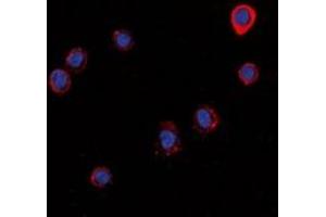 Immunofluorescent analysis of Histamine H1 Receptor staining in LOVO cells.