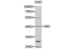 Western Blotting (WB) image for anti-Histo-blood group A transferase (ABO) antibody (ABIN1870743) (ABO 抗体)