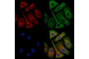 ABIN6263353 and ABIN6272349 staining Hela cells by IF/ICC. (Mrgprf 抗体  (C-Term))