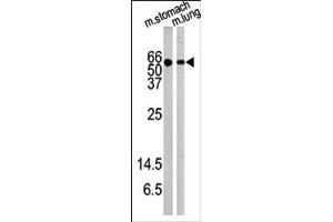 Image no. 1 for anti-V-Akt Murine Thymoma Viral Oncogene Homolog 1 (AKT1) (pTyr326) antibody (ABIN358076) (AKT1 抗体  (pTyr326))