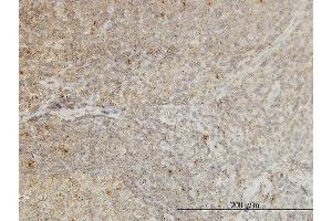 Immunoperoxidase of monoclonal antibody to CDKL4 on formalin-fixed paraffin-embedded human tonsil. (CDKL4 抗体  (AA 196-295))