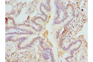 Immunohistochemistry of paraffin-embedded human lung tissue using ABIN7152931 at dilution of 1:100 (FCN1 抗体  (AA 30-326))