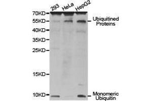 Western Blotting (WB) image for anti-Ubiquitin B (UBB) antibody (ABIN1875247) (Ubiquitin B 抗体)