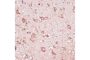 Immunohistochemistry (IHC) image for anti-Ectonucleoside Triphosphate diphosphohydrolase 6 (ENTPD6) (AA 61-300) antibody (ABIN7266897)
