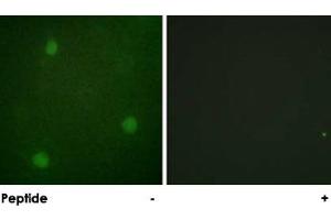 Immunofluorescence analysis of NIH/3T3 cells, using DCLRE1C polyclonal antibody . (DCLRE1C 抗体)