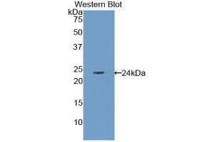 Western blot analysis of the recombinant protein. (RBP4 抗体  (AA 18-201))