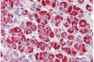 Human Adrenal (formalin-fixed, paraffin-embedded) stained with HSPD1 antibody ABIN462365 followed by biotinylated anti-goat IgG secondary antibody ABIN481715, alkaline phosphatase-streptavidin and chromogen. (HSPD1 抗体)