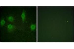 Immunofluorescence analysis of HuvEc cells, using IL-9R (Phospho-Ser519) Antibody. (IL9 Receptor 抗体  (pSer519))