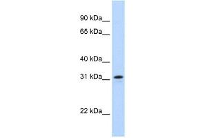 WB Suggested Anti-MKI67IP Antibody Titration:  0. (NIFK 抗体  (Middle Region))