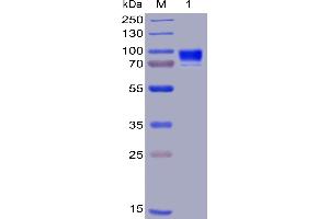 SDS-PAGE (SDS) image for Interleukin 3 Receptor, alpha (IL3RA) (AA 19-305) protein (Fc-His Tag) (ABIN6961076)