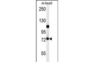 Western blot analysis in mouse heart tissue lysates (15ug/lane). (USP49 抗体  (N-Term))
