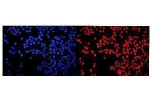 IF analysis of HMGN2 using anti-HMGN2 antibody (ABIN6719576).