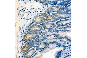 Immunohistochemistry analysis of paraffin embedded mouse small intestine using CA13 (ABIN7073310) at dilution of 1: 400