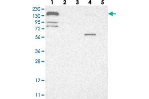 Western blot analysis of Lane 1: RT-4, Lane 2: U-251 MG, Lane 3: Human Plasma, Lane 4: Liver, Lane 5: Tonsil with CGN polyclonal antibody  at 1:250-1:500 dilution. (Cingulin 抗体)