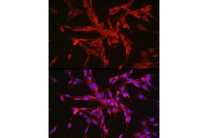 Immunofluorescence (IF) image for anti-Catenin (Cadherin-Associated Protein), alpha 2 (CTNNA2) (AA 150-300) antibody (ABIN7266134)