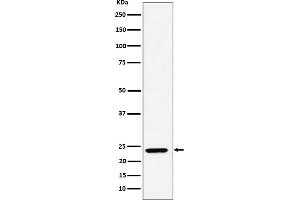 Western blot analysis of DNAJC12 expression in A549 cell lysate.