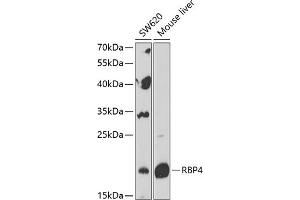 Western blot analysis of extracts of various cell lines, using RBP4 Antibody (ABIN6128555, ABIN6146803, ABIN6146804 and ABIN6216143) at 1:1000 dilution. (RBP4 抗体  (AA 19-201))