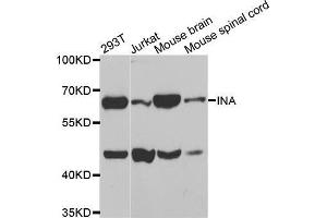 Western blot analysis of extracts of various cell lines, using INA antibody. (INA 抗体)