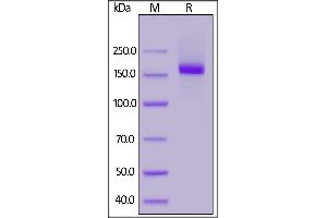 Human CD206, His Tag on  under reducing (R) condition. (Macrophage Mannose Receptor 1 Protein (AA 19-1389) (His tag))