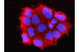 IF analysis of OMP using anti-OMP antibody (ABIN7601711). (OMP 抗体  (AA 43-163))