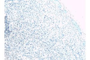 (ABIN185584) Negative Control showing staining of paraffin embedded Human Heart, with no primary antibody.