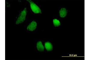 Immunofluorescence of purified MaxPab antibody to ZNF394 on HeLa cell. (ZNF394 抗体  (AA 1-561))