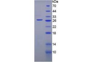 SDS-PAGE analysis of Mouse Gremlin 1 Protein. (GREM1 蛋白)