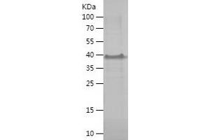 MAGEA8 Protein (AA 1-318) (His tag)