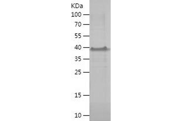 MAGEA8 Protein (AA 1-318) (His tag)