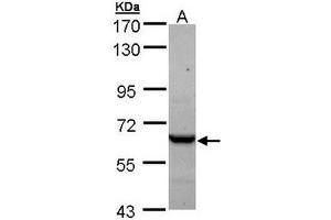 TCP1 epsilon Antibody staining of A431 (A) whole cell lysate (30 µg) at 1/1000 dilution, 7. (CCT5 抗体  (AA 1-224))
