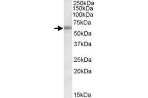CDH23 polyclonal antibody  (1 ug/mL) staining of human amygdala lysate (35 ug protein in RIPA buffer). (CDH23 抗体)