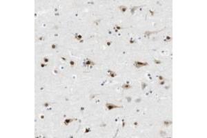 Immunohistochemical staining of human cerebral cortex with RNF38 polyclonal antibody  shows strong nuclear and moderate cytoplasmic positivity in neuronal cells. (RNF38 抗体)