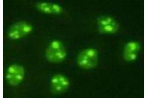 Immunocytochemistry (ICC) image for anti-PiggyBac Transposable Element Derived 5 (PGBD5) antibody (ABIN1112920) (PGBD5 抗体)