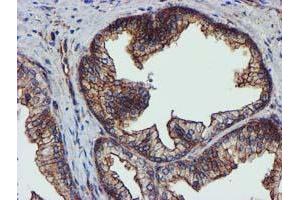 Image no. 10 for anti-Epsin 2 (EPN2) antibody (ABIN1498051) (Epsin 2 抗体)