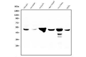 Western blot analysis of FH using anti-FH antibody (ABIN7603168).
