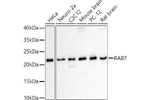 Western blot analysis of extracts of various cell lines, using R antibody (ABIN6133888, ABIN6146605, ABIN6146608 and ABIN6216535) at 1:1000 dilution. (RAB7A 抗体  (C-Term))