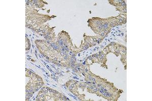 Immunohistochemistry of paraffin-embedded human prostate using IFNG antibody. (Interferon gamma 抗体)