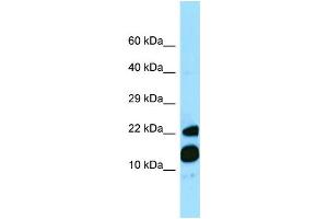 WB Suggested Anti-MRFAP1 Antibody Titration: 1. (MRFAP1 抗体  (C-Term))