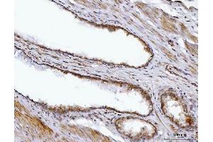 IHC analysis of BBS9 using anti-BBS9 antibody (ABIN7601518). (BBS9 抗体  (AA 37-793))