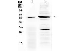 Western blot analysis of TNFRSF1A using anti- TNFRSF1A antibody . (TNFRSF1A 抗体  (AA 89-145))