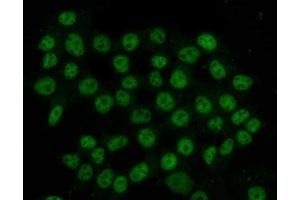 IF analysis of HnRNP H/HNRNPH1 using anti-HnRNP H/HNRNPH1 antibody (ABIN4886623). (HNRNPH1 抗体  (N-Term))