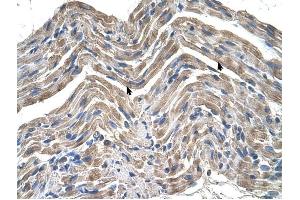 Neuroplastin antibody was used for immunohistochemistry at a concentration of 4-8 ug/ml to stain Skeletal muscle cells (arrows) in Human Muscle. (NPTN 抗体  (Middle Region))