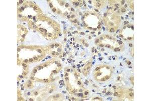 Immunohistochemistry of paraffin-embedded Human kidney using SUPT20H Polyclonal Antibody at dilution of 1:100 (40x lens). (FAM48A/P38IP 抗体)