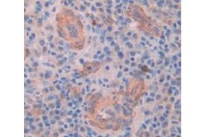 Used in DAB staining on fromalin fixed paraffin- embedded Kidney tissue (MYO5A 抗体  (AA 1531-1855))