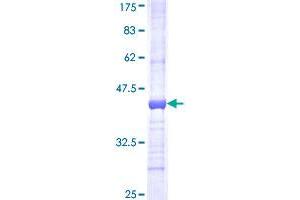 GBE1 Protein (AA 605-702) (GST tag)