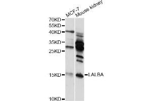 Western blot analysis of extracts of various cell lines, using LALBA antibody (ABIN6292168) at 1:3000 dilution. (LALBA 抗体)